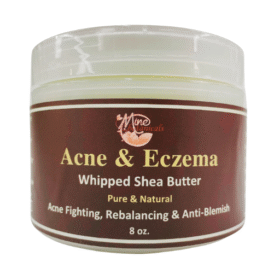 Acne & Eczema Whipped Shea Butter