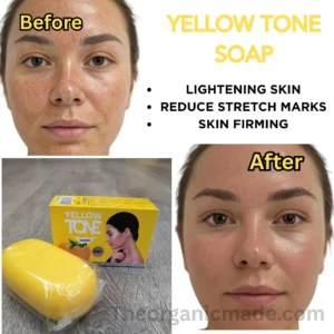 Yellow Tone Body Soap 200g -Vitamin C&E BRIGHTENS | FIRMS & REDUCES STRETCH marks