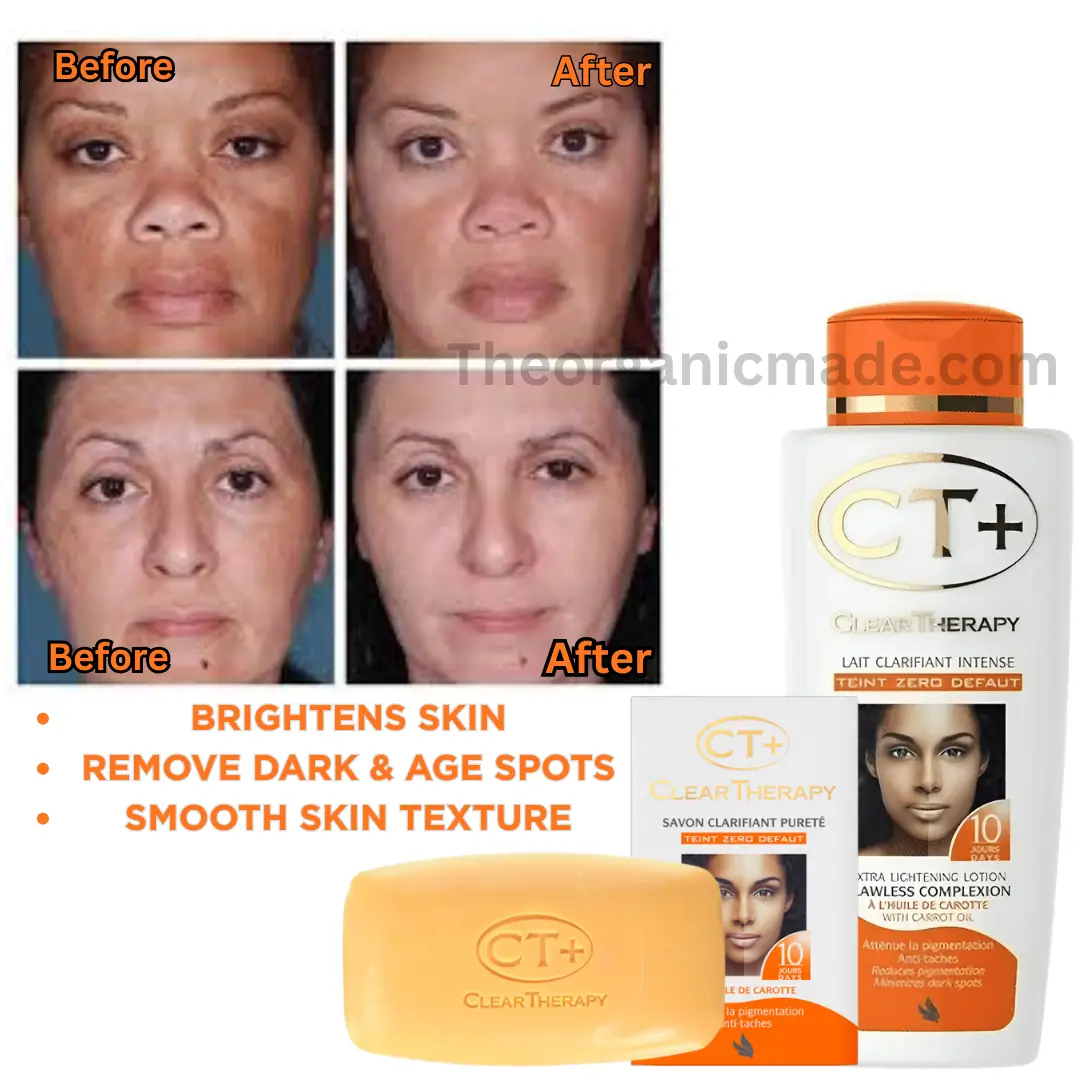 CT+ Clear Therapy Extra Lightening Carrot Lotion 500ml With Carrot Oil & Soap 175g (Pack of 2) 1 CT+ Clear Therapy Extra Lightening Carrot Lotion 500ml With Carrot Oil & Soap 175g (Pack of 2)