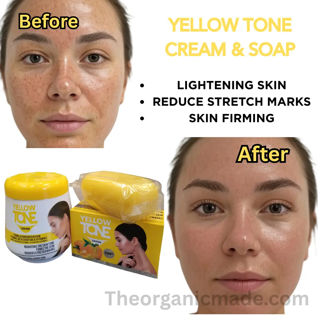 Yellow Tone Beauty Cream 450ml with Soap 200g - Stretch Marks Remover (Pack of 2) 1 Yellow Tone Beauty Cream 450ml with Soap 200g - Stretch Marks Remover (Pack of 2)