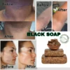 Black Soap Bar - Acne & Dark Spot Eraser 5 women with acne and eczema used black soap to have clean face fresh skin