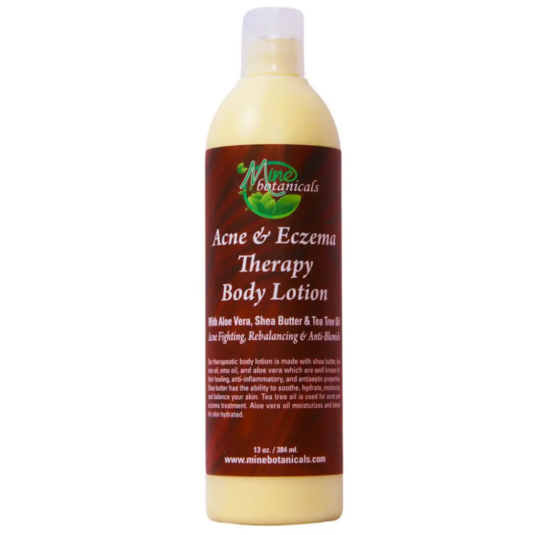 ACNE & ECZEMA THERAPY Body Lotion With Aloe Vera By Mine Botanicals - 13 Oz 1 ACNE & ECZEMA THERAPY Body Lotion With Aloe Vera By Mine Botanicals - 13 Oz