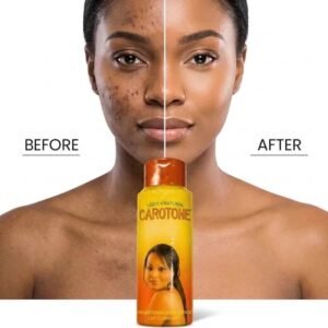 Carotone Lotion 3 in 1 - Light & Natural 550 ml